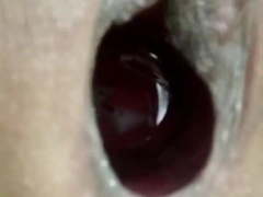 Insertions